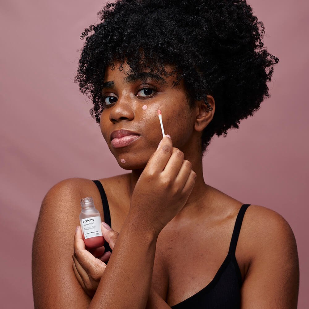 Kit Loção Secativa de Espinhas + Solução Antiacne Corporal (2 Produtos) ÚNICO 5