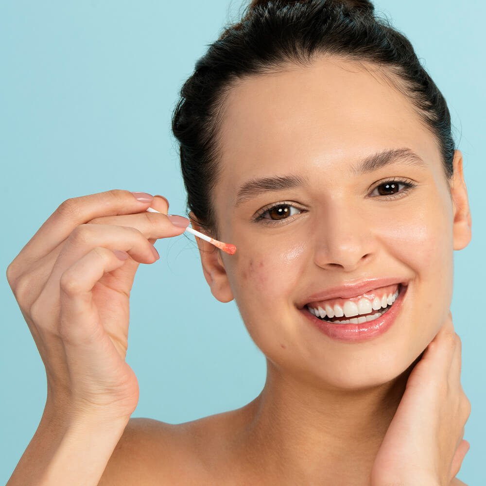 Kit Loção Secativa de Espinhas (2 Produtos) ÚNICO 6