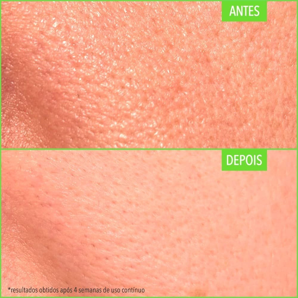 Kit Pore Corrector + Tônico Facial (2 Produtos) ÚNICO 5