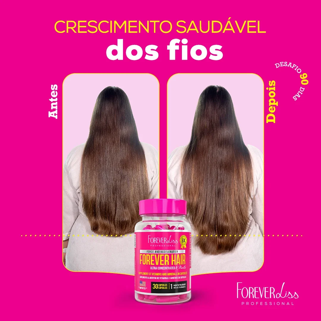 Combo Tratamento 12 Meses Forever Hair Crescimento Capilar ÚNICO 3