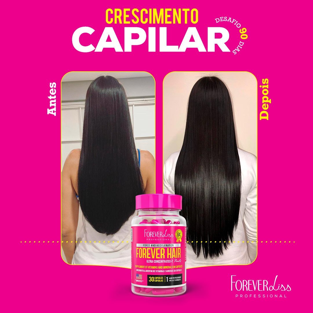 Combo Tratamento 12 Meses Forever Hair Crescimento Capilar ÚNICO 5