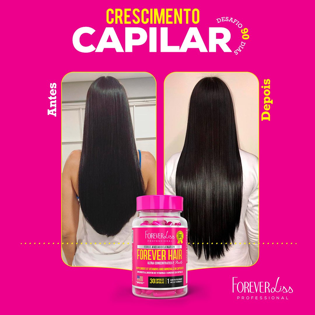 Combo Tratamento 3 Meses Forever Hair Crescimento Capilar - MKT ÚNICO 2
