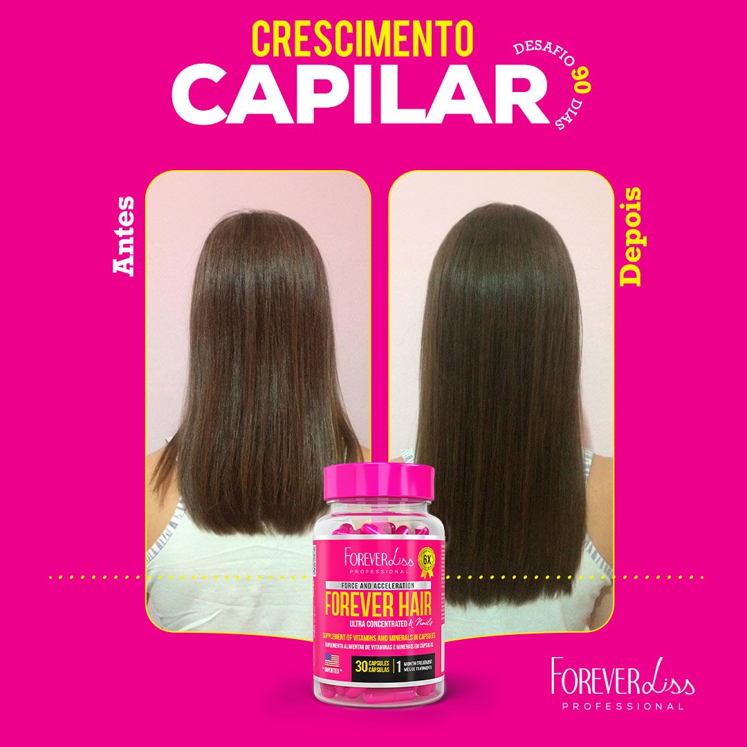 Combo Tratamento 3 Meses Forever Hair Crescimento Capilar - MKT ÚNICO 3
