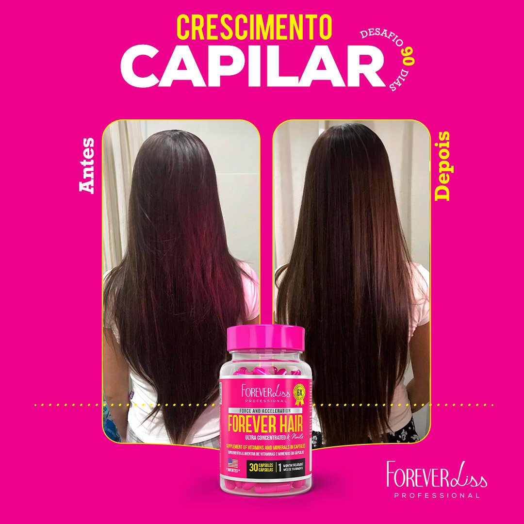 Combo Tratamento 3 Meses Forever Hair Crescimento Capilar - MKT ÚNICO 4