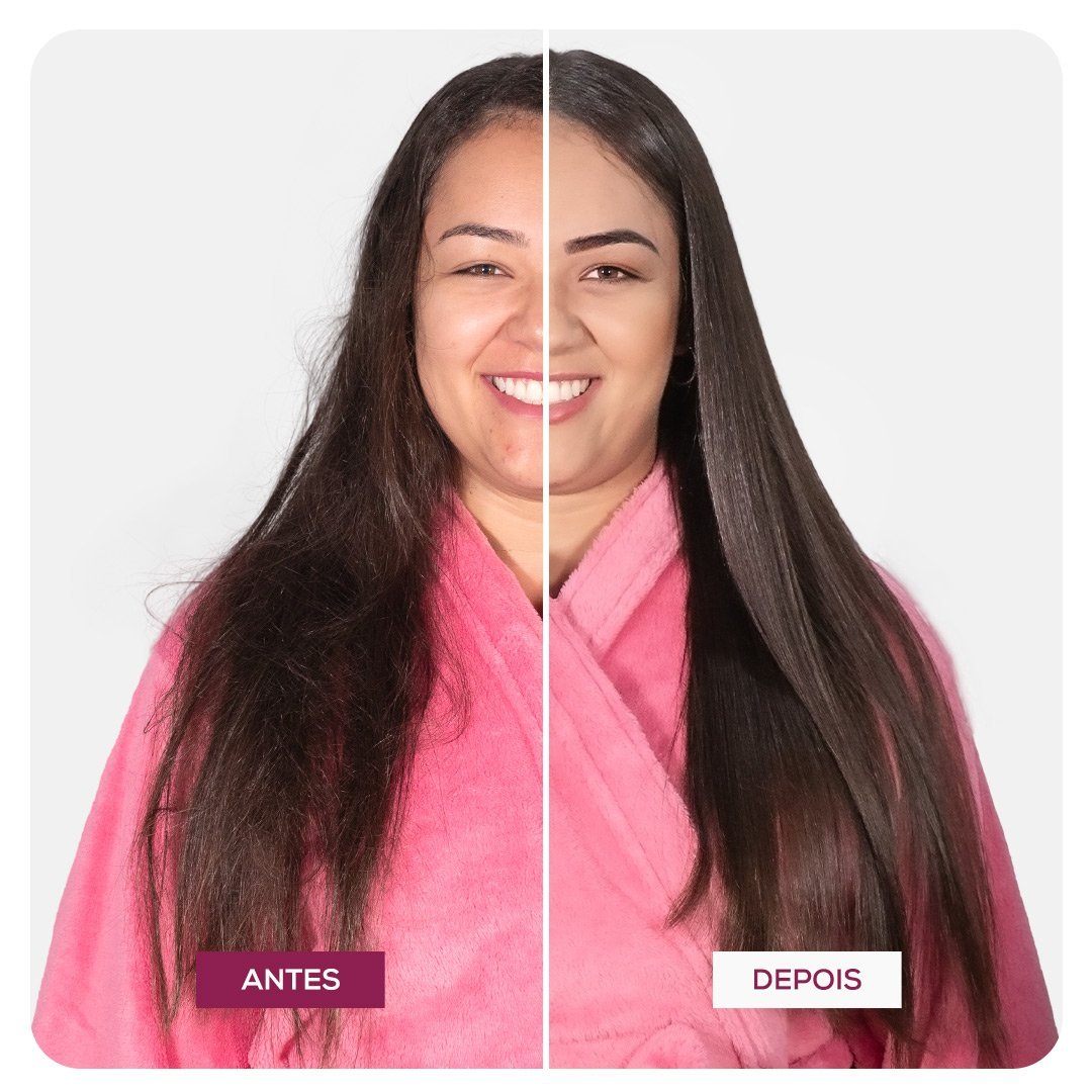 Kit Vinagre Com Sos Antiemborrachamento Forever Liss ÚNICO 4