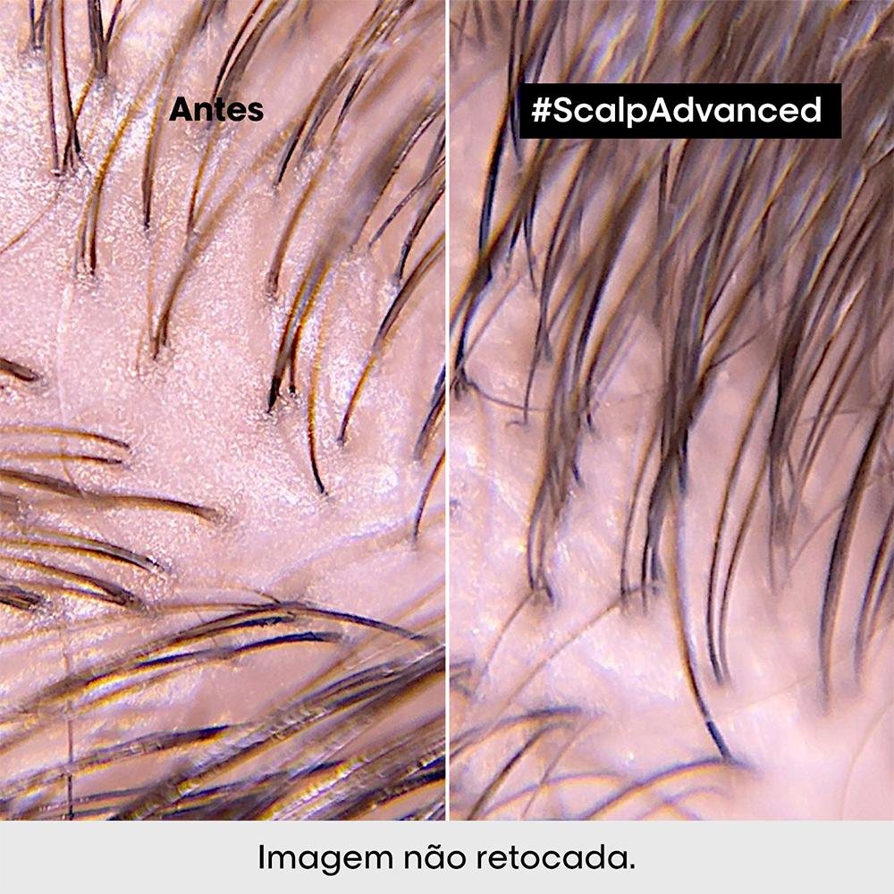 L'Oréal Professionnel  Serie Expert Scalp Advanced Dermo Purifier Shampoo 300ml 300ml 4