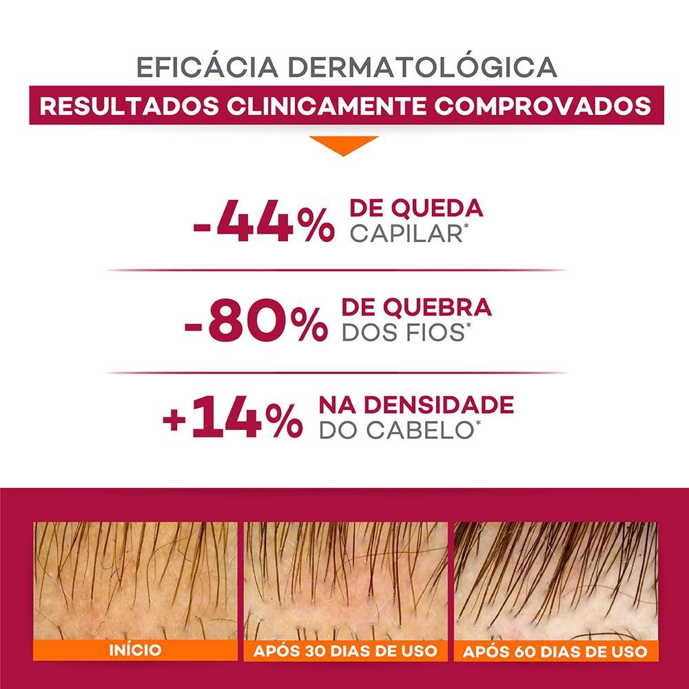 Darrow Doctar Force Shampoo Antiqueda 400ml 400ml 5