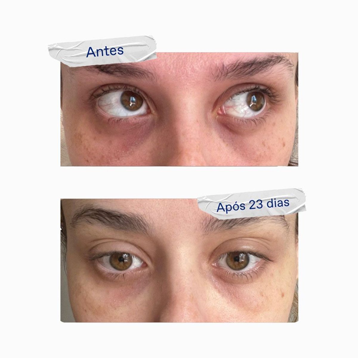 Korres Greek Yoghurt Antifadiga - Serum Gel para Olhos 15ml 15ml 5