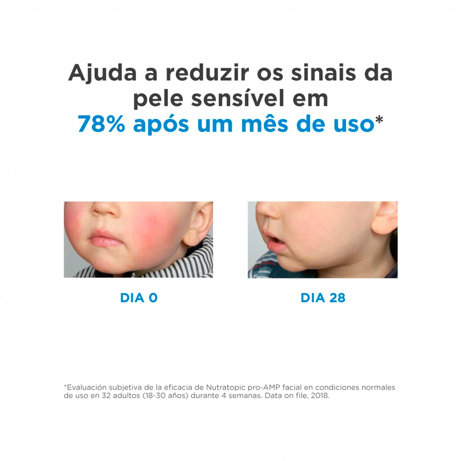ISDIN Nutratopic Pro-AMP - Creme Facial Pele Atopica 50,5g 50,5g 2