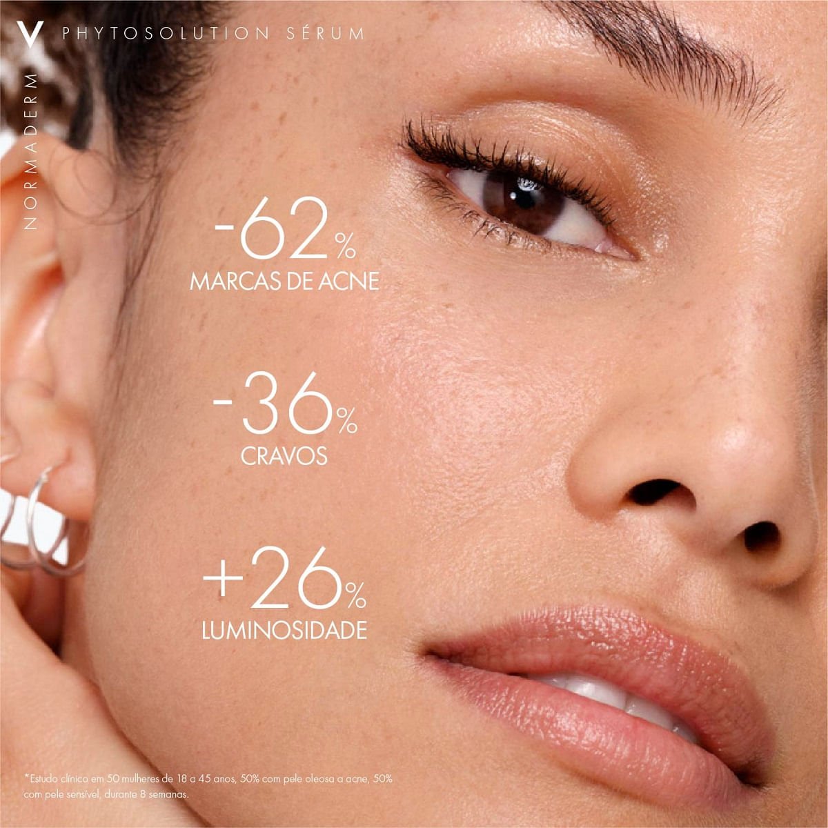 Sérum Vichy Normaderm Phytosolution Antioleosidade e Antiacne 50ml 50ml 6