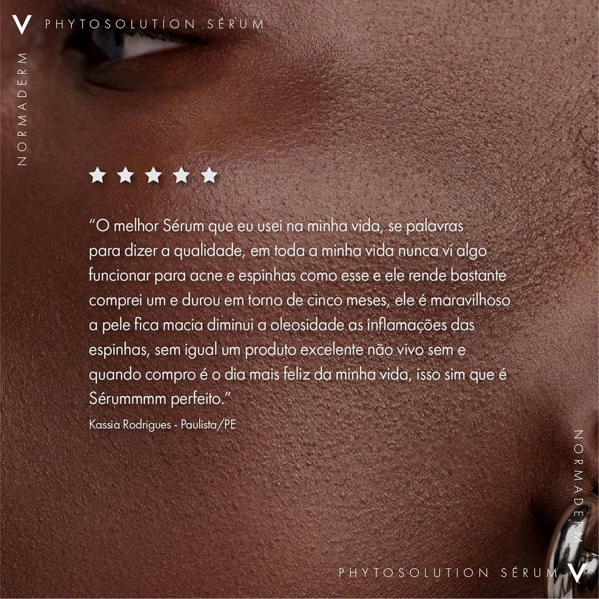 Sérum Vichy Normaderm Phytosolution Antioleosidade e Antiacne 50ml 50ml 9