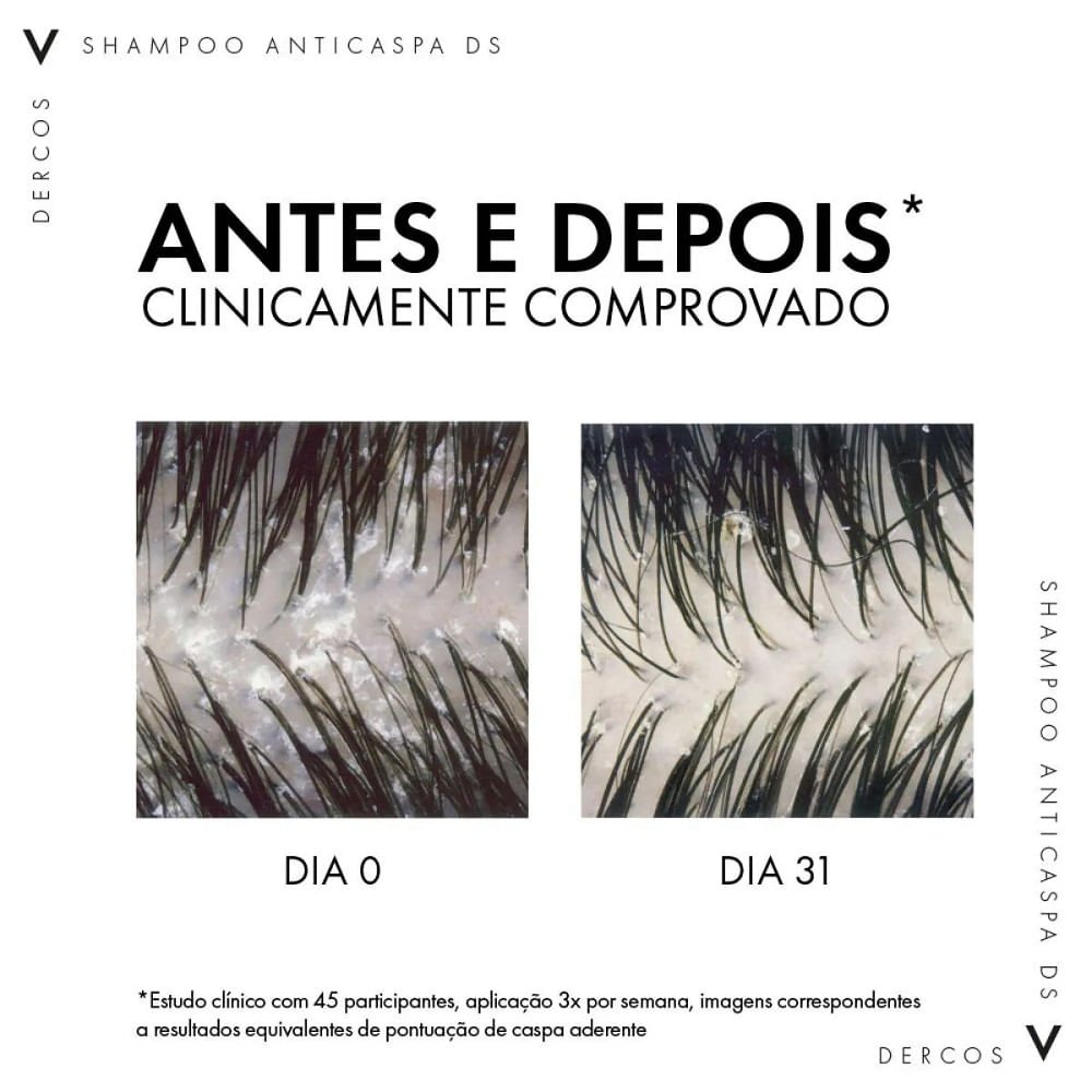 Refil Shampoo Anticaspa Ds Vichy Dercos Oily Cabelos Normais a Oleosos 200g 200g 8
