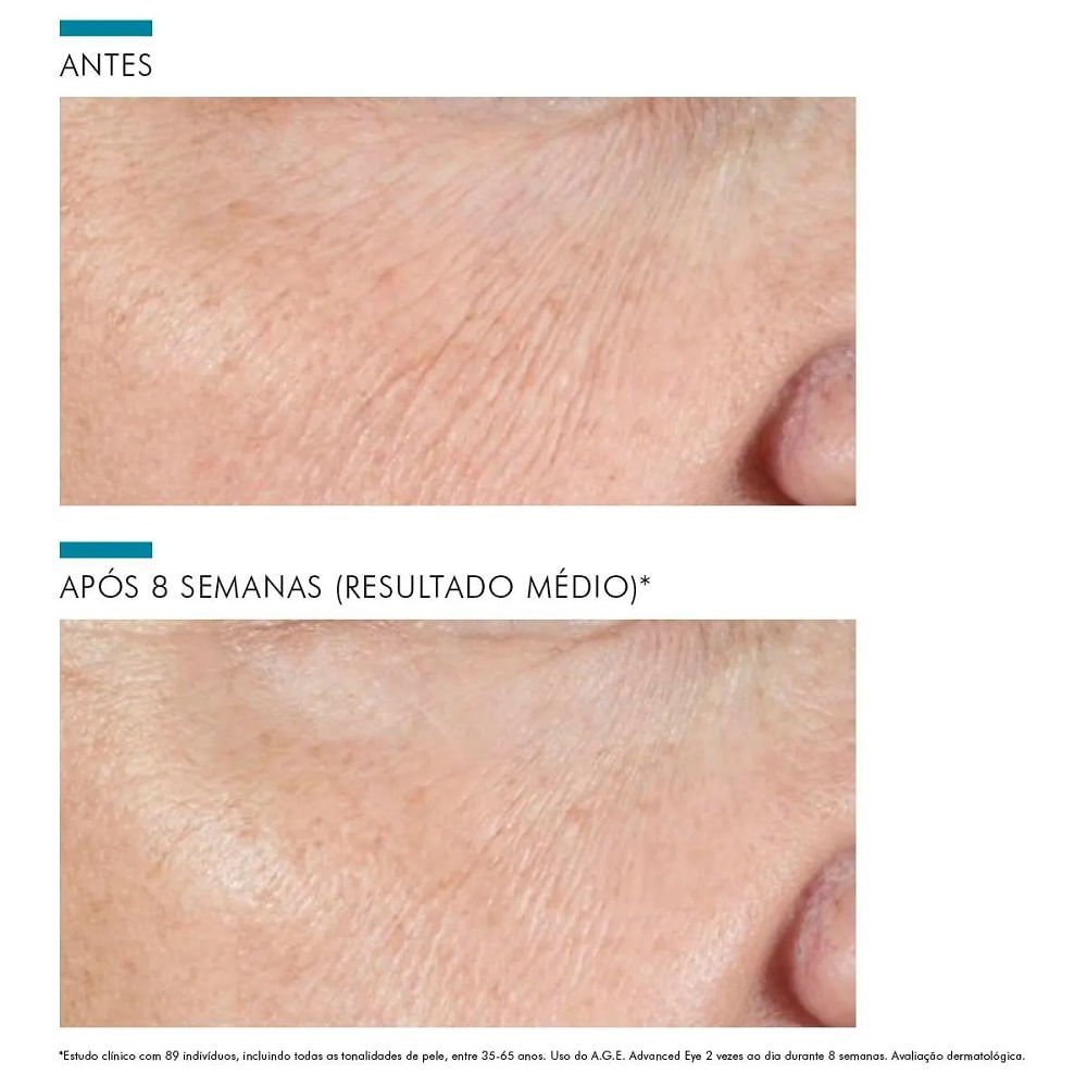 Creme Corretor para a Área dos Olhos Skinceuticals A.g.e. Advanced Eye 15ml 15ml 5