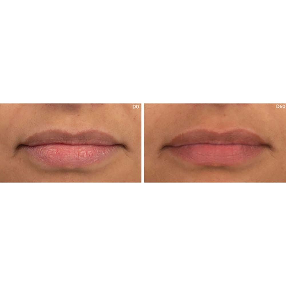 Hidratante Labial Adcos Ultra Nutrição 3,2g 3,2g 5