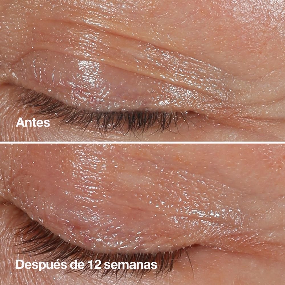 Creme Antirrugas para área dos olhos Clinique Smart 15ml 7