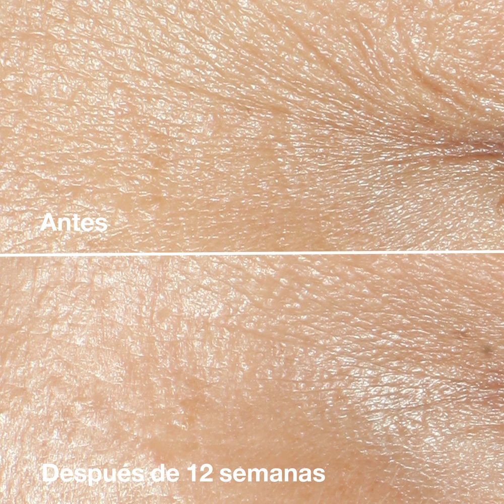 Hidratante Anti-Idade Clinique Smart Clinical Repair - 15ml 15ml 2