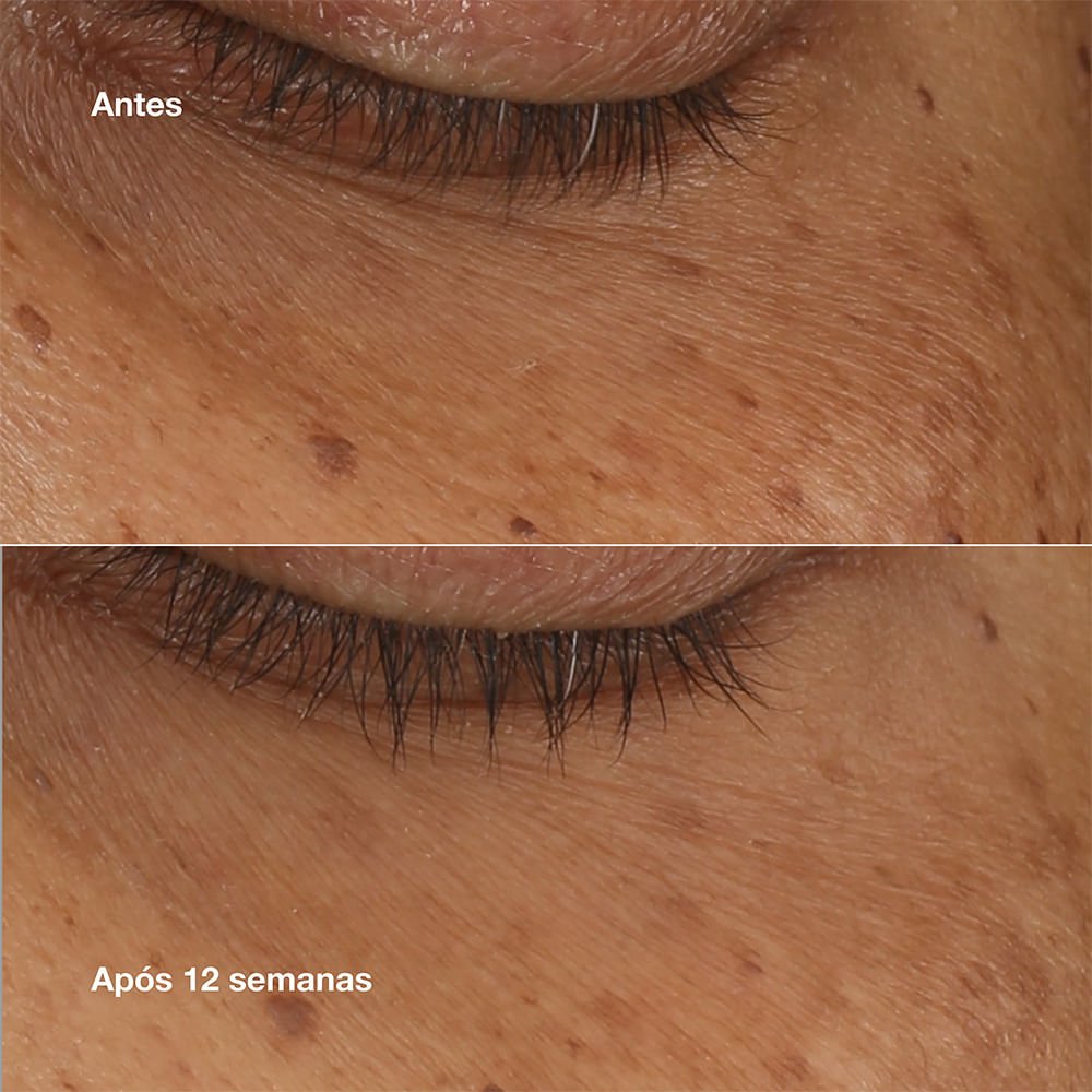 Sérum Iluminador Olhos Clinique All About Eyes™ Brightening ÚNICO 3