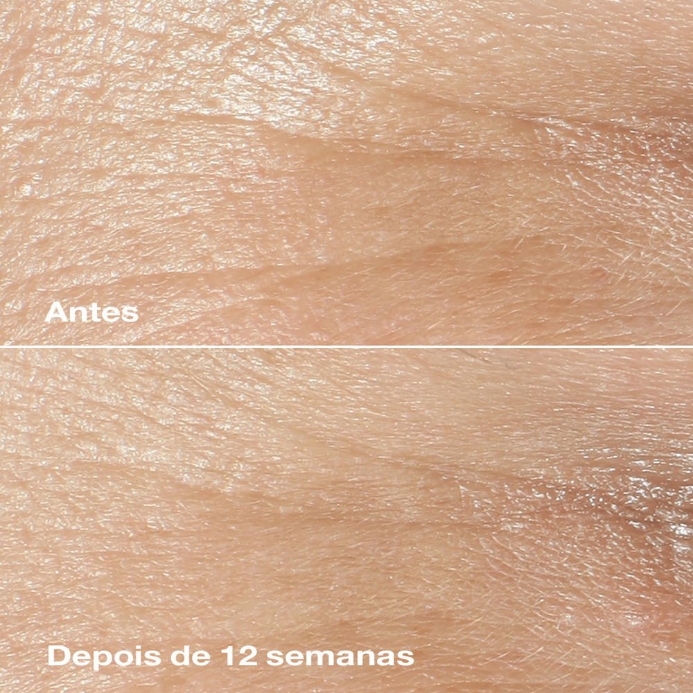 Kit Antirrugas Smart™ - Edição Limitada ÚNICO 3