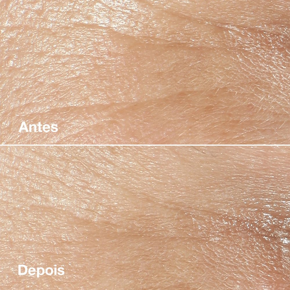 Kit Antirrugas Smart™ - Edição Limitada ÚNICO 4