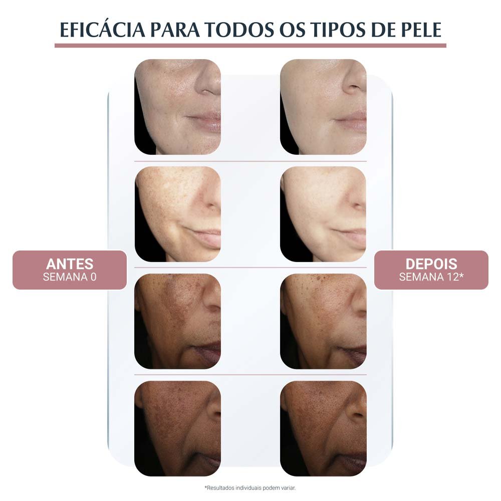Creme Facial Dia Eucerin Anti-Pigment Dia FPS 30 50ml 5