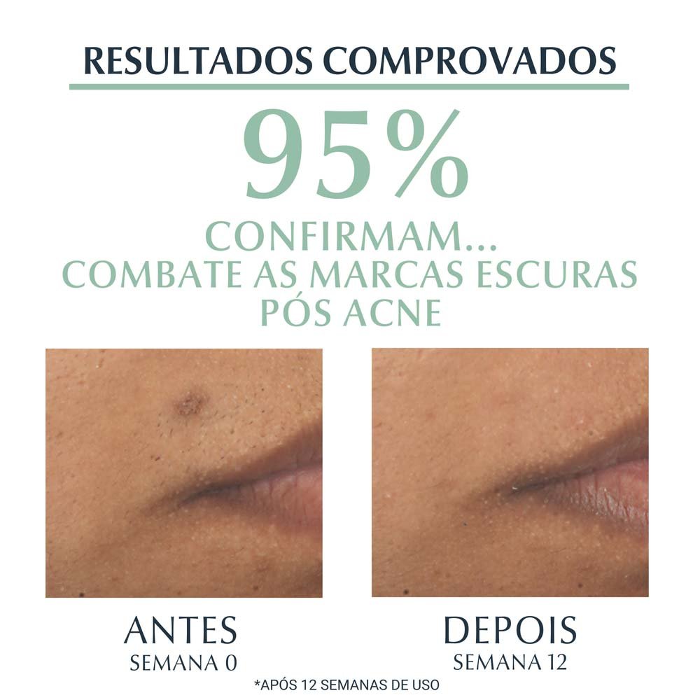 Sérum Efeito Triplo Eucerin – DermoPure Oil Control 40ml 6