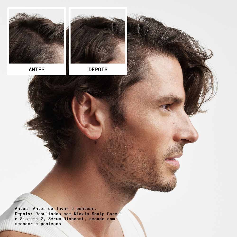 Nioxin System 2 Kit - Shampoo + Condicionador + Tratamento ÚNICO 5
