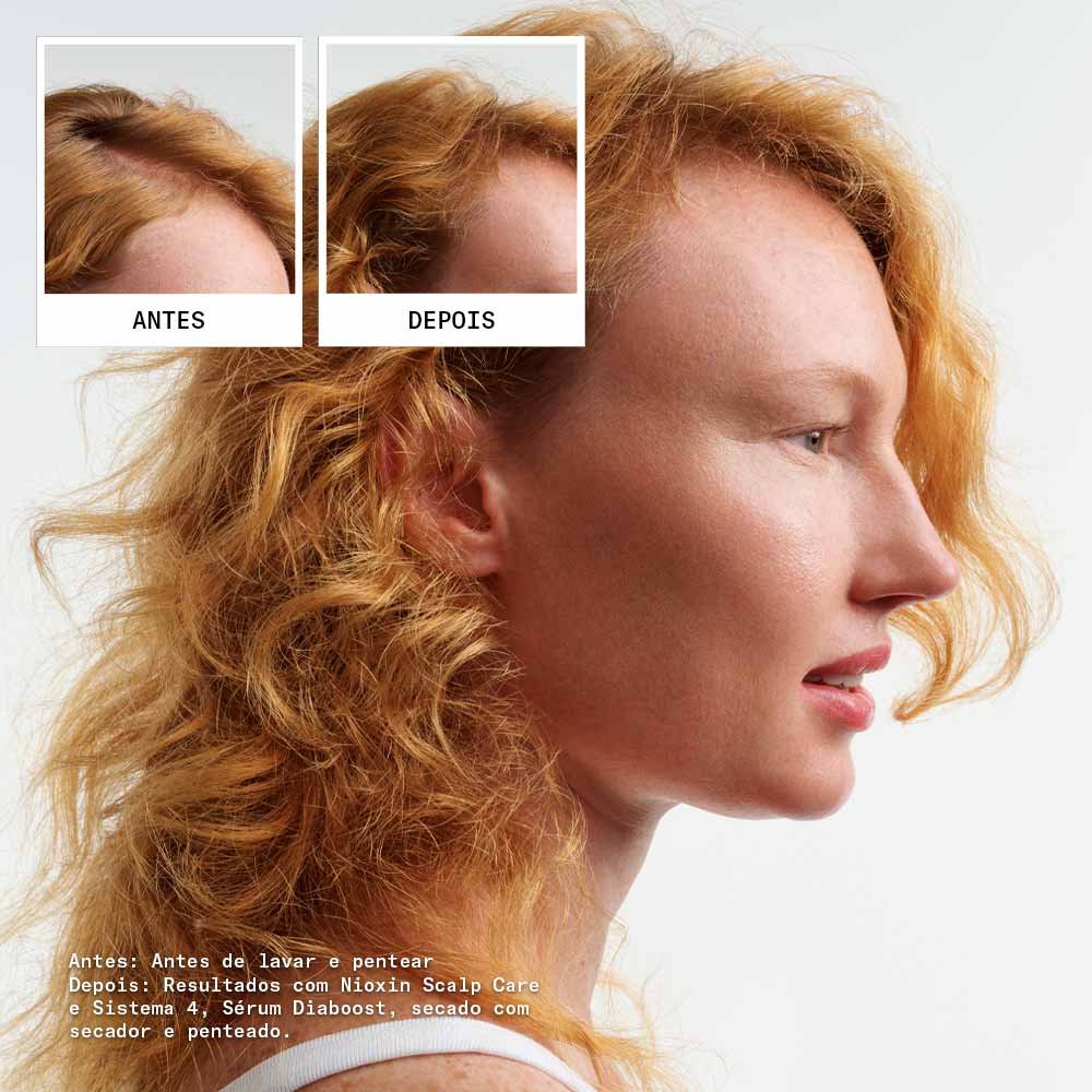 Nioxin System 4 Kit - Shampoo + Condicionador + Tratamento - kit ÚNICO 4
