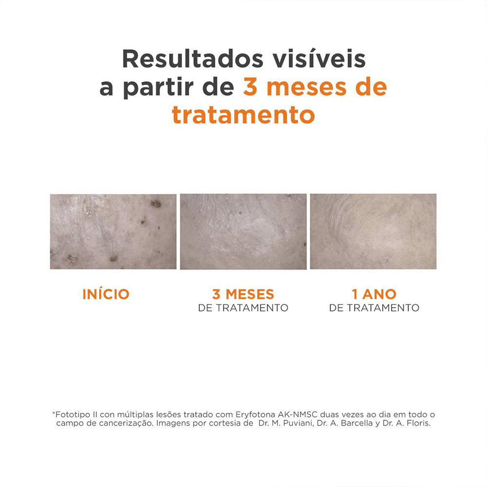 Fluido Fotoprotetor Isdin - Eryfotona AK-NMSC FPS99 50ml 3