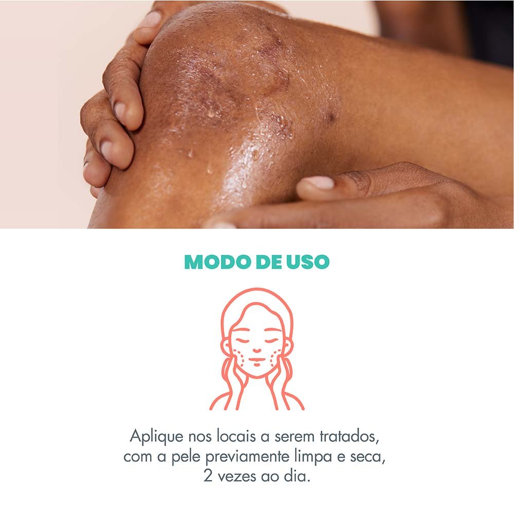 Gel Cicatrizante Facial e Corporal Avène Cicalfate+ Scar Gel ÚNICO 5