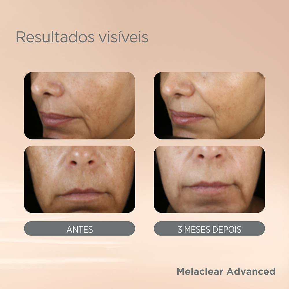 Sérum Facial Clareador Isdin - Melaclear Advanced 30ml 3