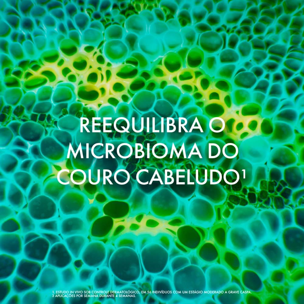 Vichy Dercos Shampoo Anticaspa DS - Cabelos Secos 300g 7