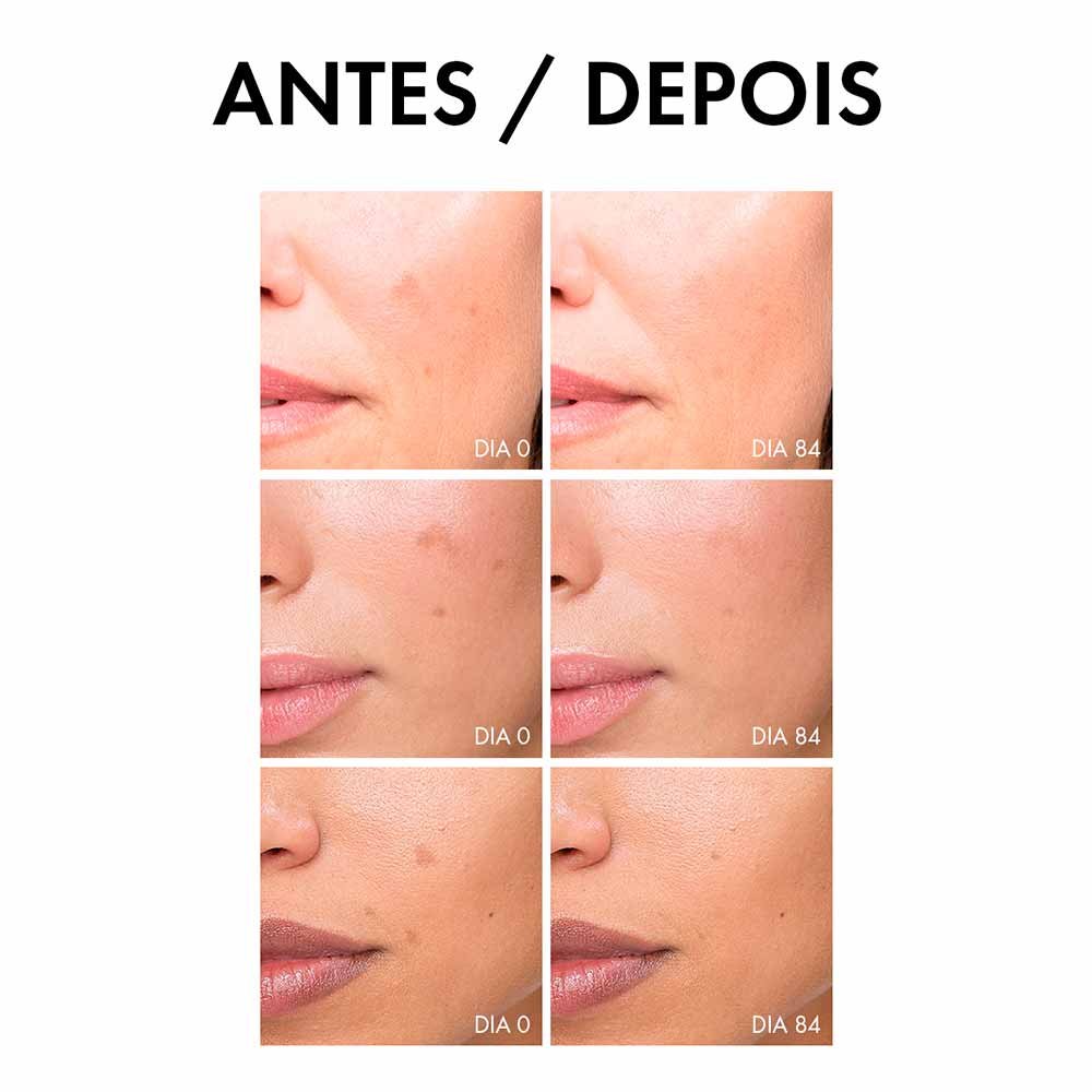 Sérum Antimanchas Vichy Liftactiv Pigment Specialist B3 30ml 9