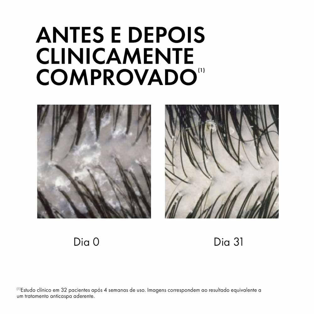 Sérum 10 Vichy Dercos Anticaspa 100ml 8