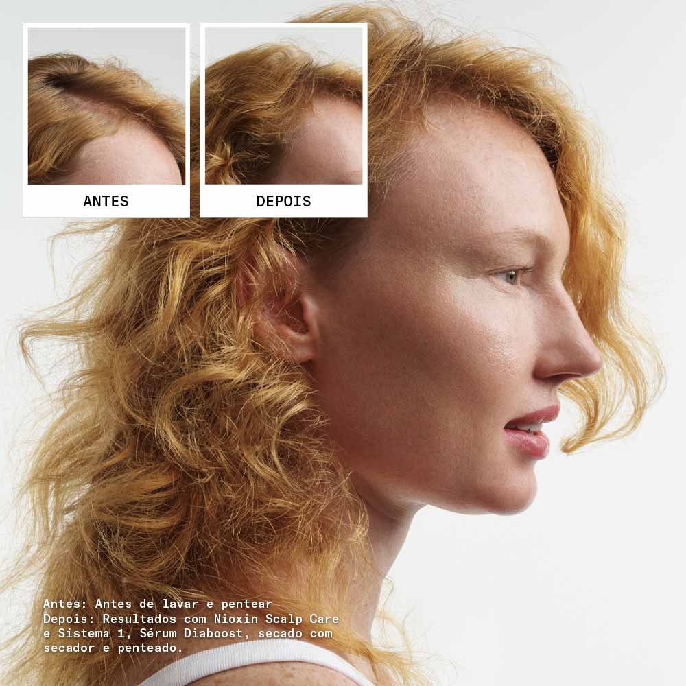 Nioxin System 1 Kit - Shampoo + Condicionador + Tratamento ÚNICO 4
