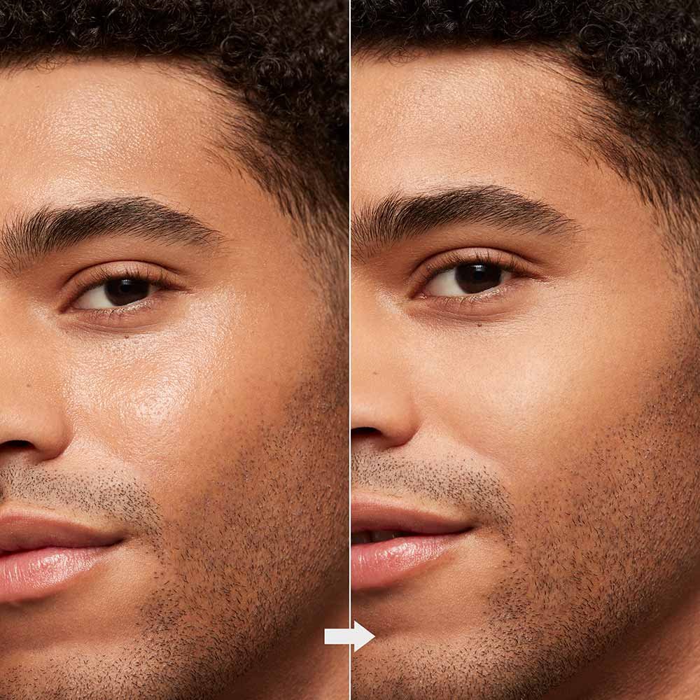 Rolo Facial para Controle da Oleosidade Revlon Volcanic Stone Roller ÚNICO 4