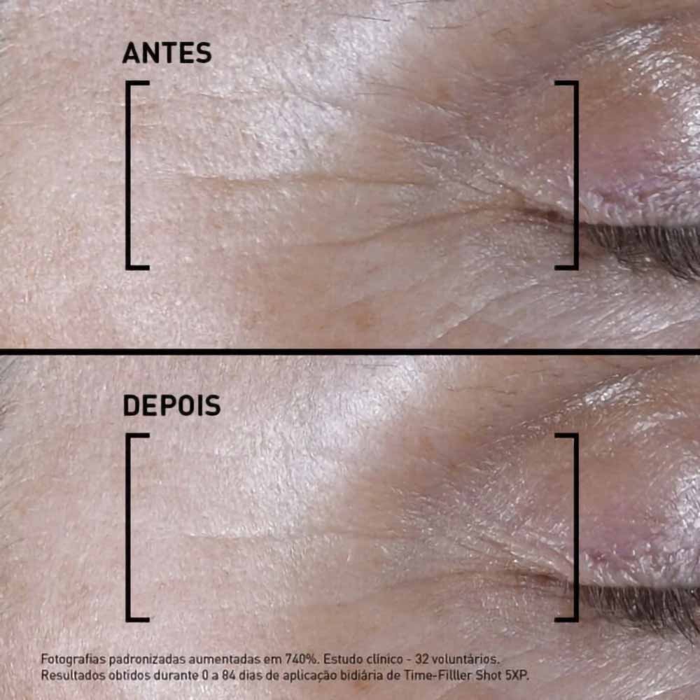 Sérum Antirrugas Concentrado Fillorga Time-Filler 5xp Shot Pen 15ml 4