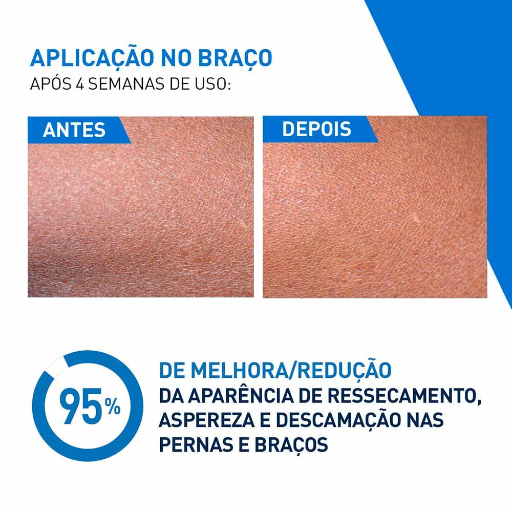 Loção Hidratante Intensiva CeraVe 5% Hidro-Urea 200ml 7