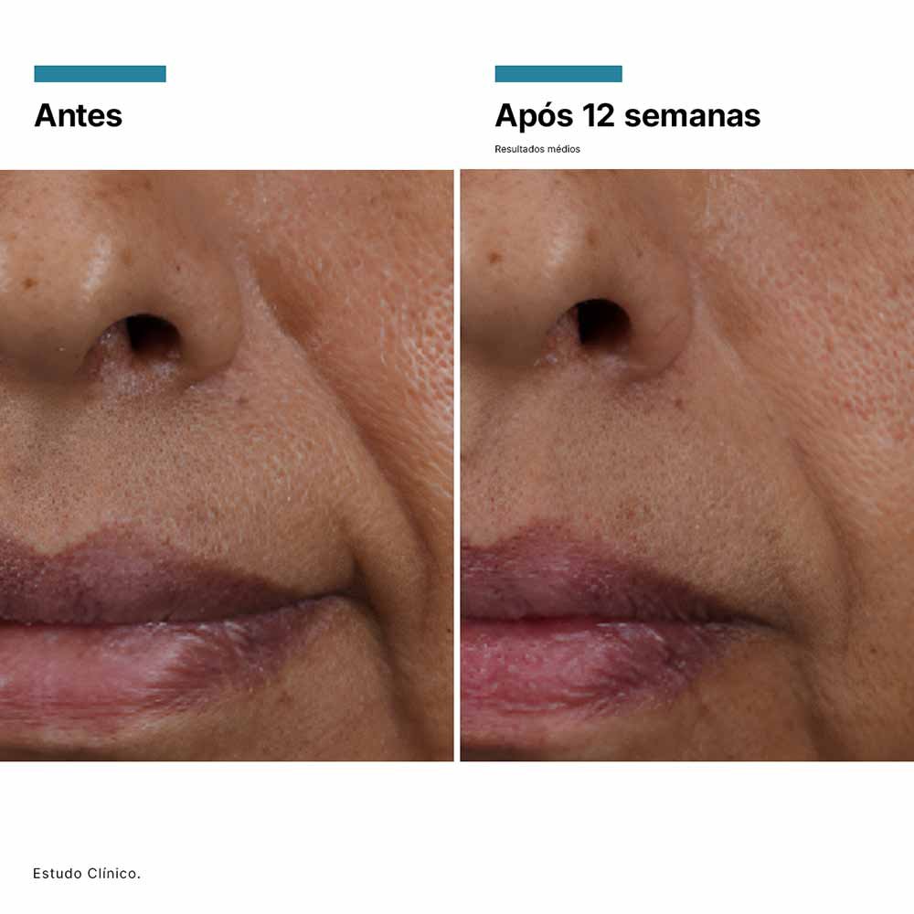 Sérum Facial Skinceuticals HA Intensifier Multi-Glycan 30ml 7