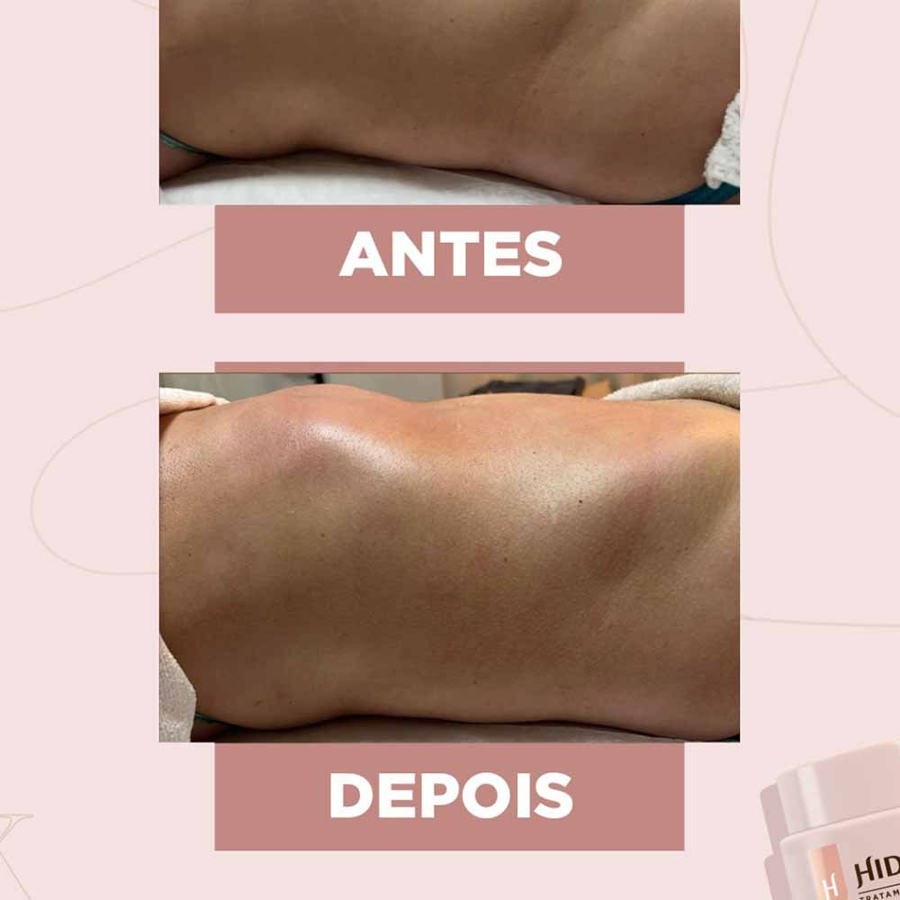 Creme de Massagem Hidramais Nano Redux 1kg 4