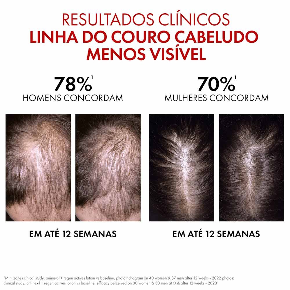 Sérum Regenerador Antiqueda Vichy Dercos Aminexil Clinical Regen Booster 100ml 5