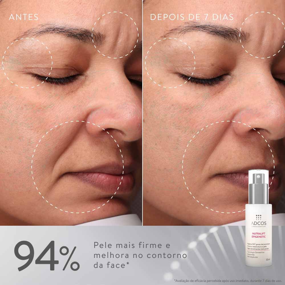 Sérum Ultraconcentrado Rejuvenescedor ADCOS Nutralift Epigenetic 30ml 7