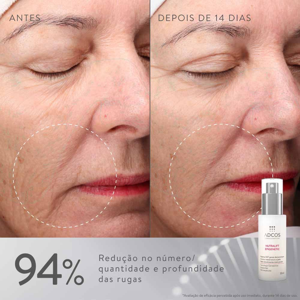 Sérum Ultraconcentrado Rejuvenescedor ADCOS Nutralift Epigenetic 30ml 8