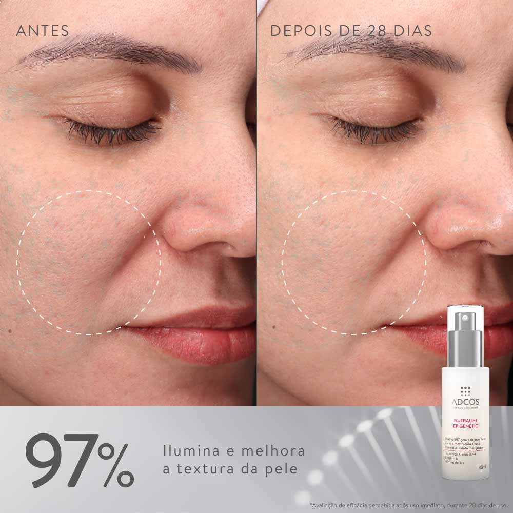 Sérum Ultraconcentrado Rejuvenescedor ADCOS Nutralift Epigenetic 30ml 9