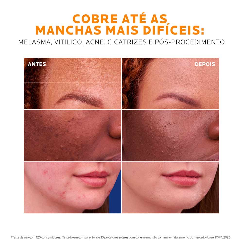 Protetor Solar Facial La Roche-Posay Anthelios Ultra Cover+ FPS 85 Cor 3.5 9