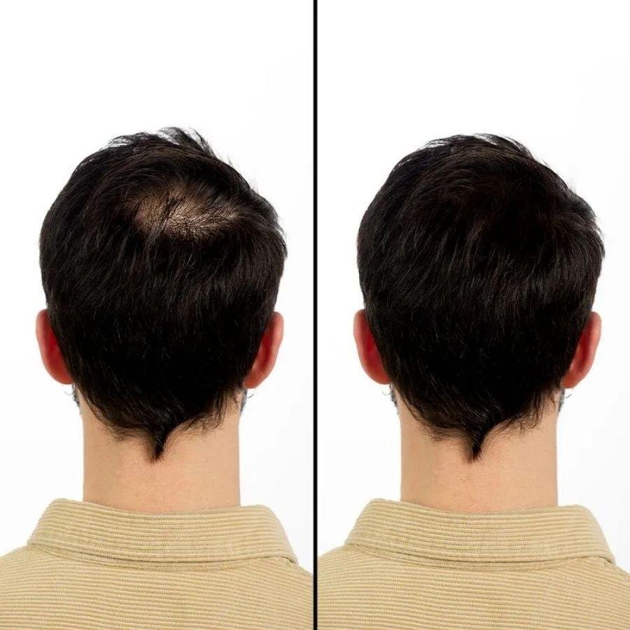 Fibra Capilar Vertix para Cabelos Pretos 25g 25g 4