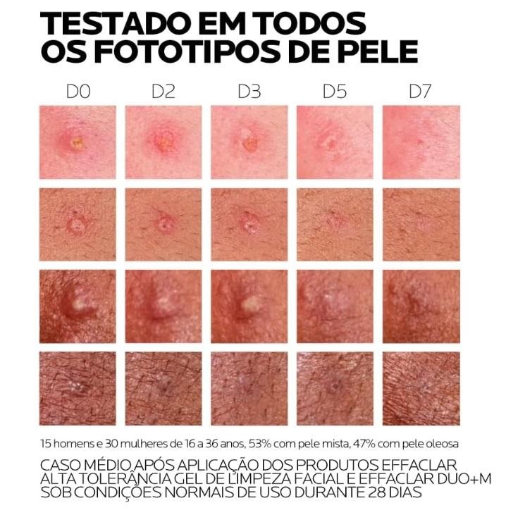 Effaclar Duo+M Creme Antiacne La Roche Posay 40ml 40ml 5