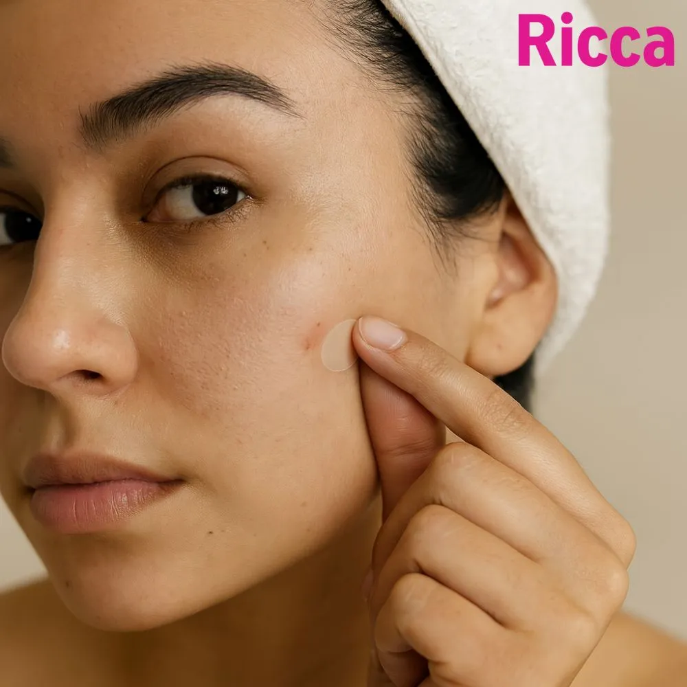 Adesivo Secativo para Acnes Fase Inicial - Ricca ÚNICO 5