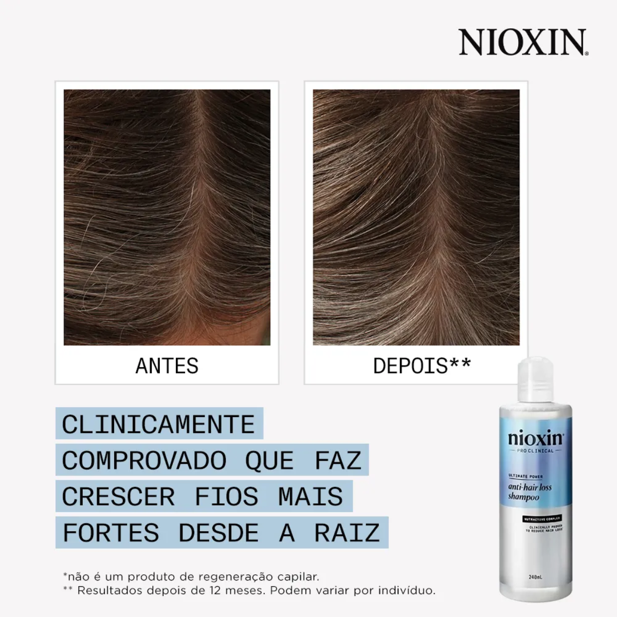 Nioxin Anti Hair Loss Shampoo 240ml 240ml 5