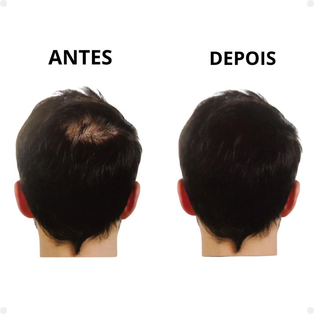 Kit Vertix: Fibra Capilar Castanho Escuro, Aplicador e Spray Extraforte ÚNICO 6