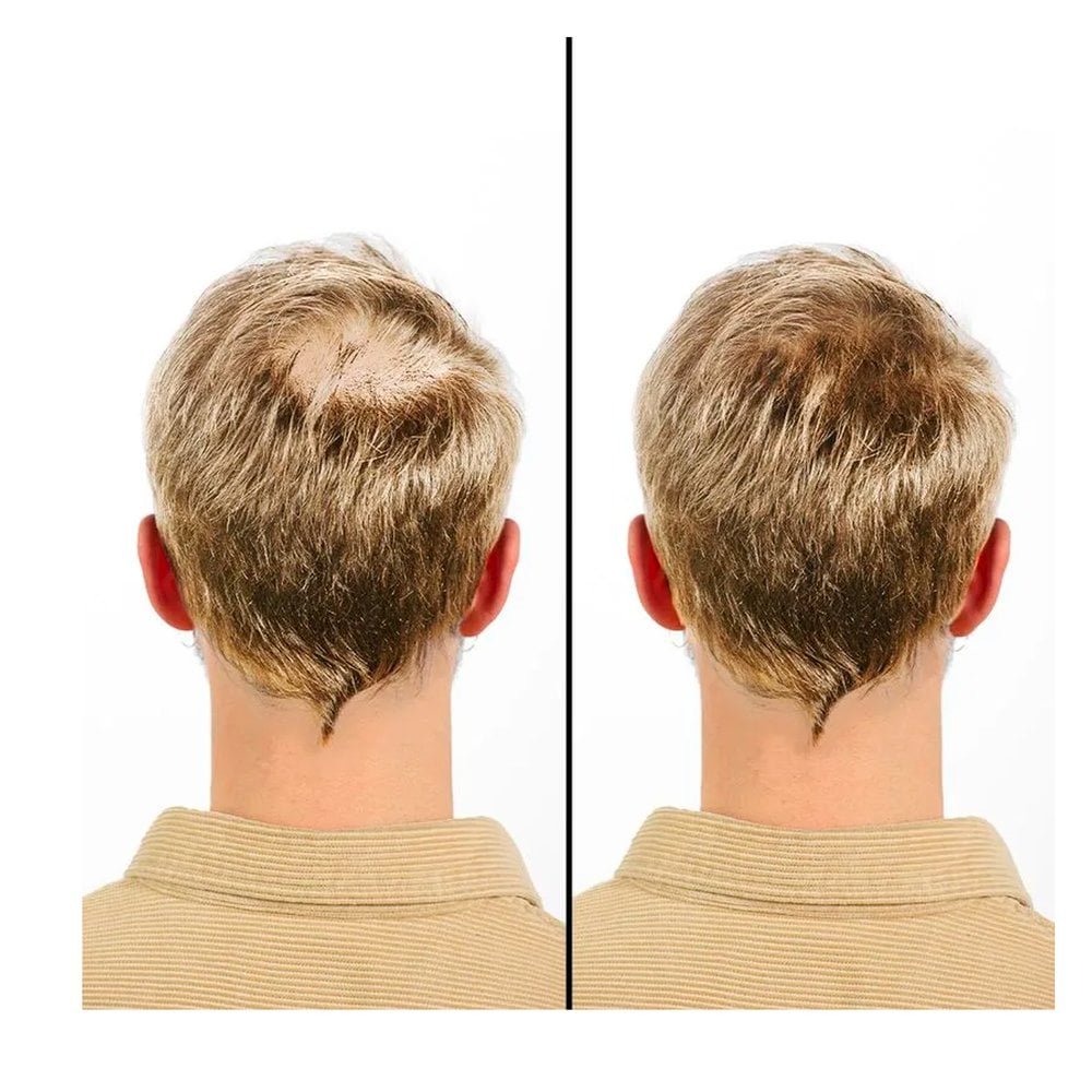 Fibra Capilar Vertix para Cabelos Loiro 25g 25g 2